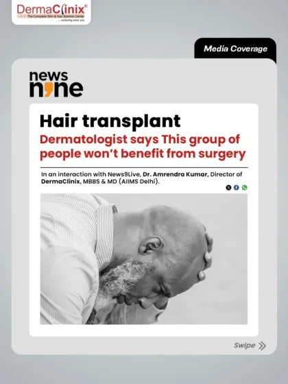 A hair transplant is not for everyone. This media coverage from News9Live discusses which groups of people may not benefit from surgery. We believe in honest consultations and will tell you if you are not an ideal candidate.