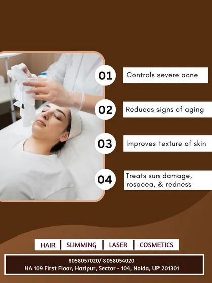Here are four key benefits of a Photofacial. It helps control severe acne, reduces signs of aging, improves skin texture, and treats issues like sun damage and rosacea.