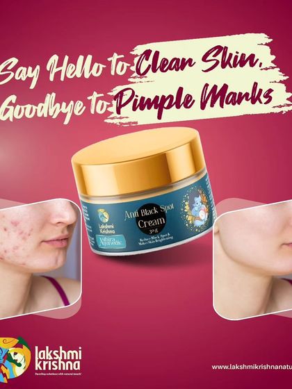 Say hello to clear skin and goodbye to pimple marks with our Anti Black Spot Cream. This before-and-after image shows its effectiveness in brightening and smoothing the skin.