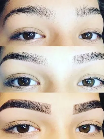 This front-on view clearly shows the dramatic yet natural transformation possible with microblading. From sparse and undefined to full and perfectly shaped, this treatment makes a huge difference.