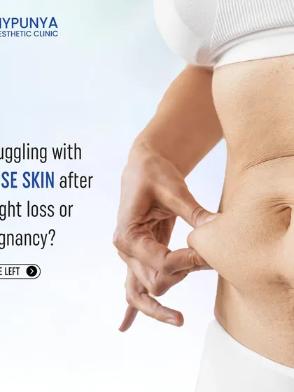 Struggling with loose skin after weight loss or pregnancy? A tummy tuck surgery might be the solution you've been looking for to restore a toned abdominal area.