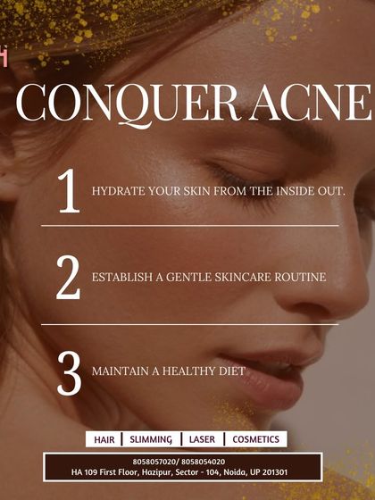 Here are three foundational steps to conquer acne: hydrate your skin from the inside out, establish a gentle and consistent skincare routine, and maintain a healthy diet. We can help you build the right routine for your skin.
