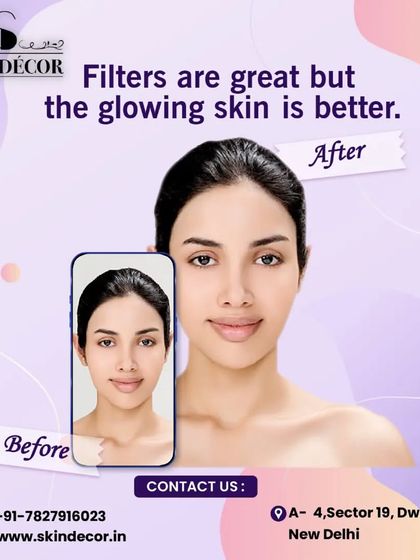 Filters are great, but glowing skin is better. My goal is to help you achieve a healthy, natural radiance that you feel confident in, without the need for a filter.