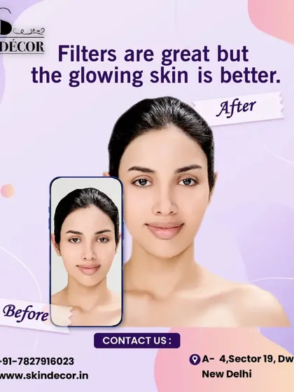 Filters are fun, but real, glowing skin is better. My goal is to help you achieve a complexion you feel confident in, without relying on filters. It's about real results and healthy skin.