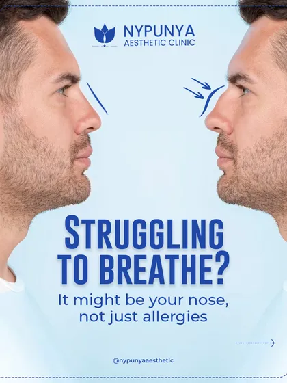 If you are struggling to breathe, it might be your nose's internal structure, not just allergies. A septoplasty, often done with rhinoplasty, can correct a deviated septum.