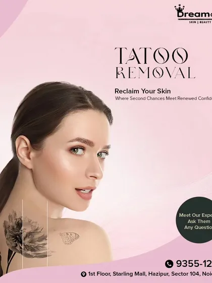 Removing a tattoo is more than a procedure; it is a journey toward renewed confidence. I am here to guide you through every step, helping you achieve the clear skin you desire.