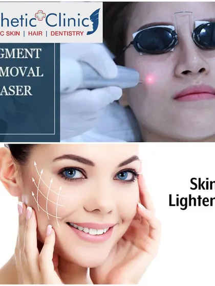 My clinic offers advanced pigment removal laser treatments and skin lightening protocols. These are designed to safely and effectively correct discoloration and improve overall skin brightness.
