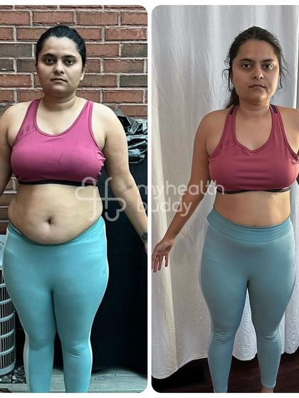 Another front view of Ruchika's amazing 10kg loss.
