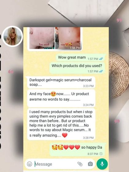 This customer used my Darkspot Gel, Magic Serum, and Charcoal soap and says her face is "awsme no words to say."
