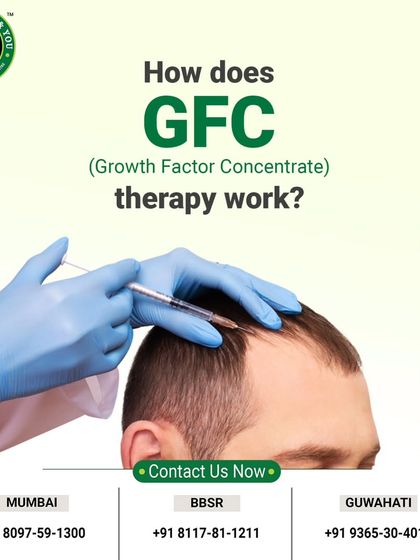 This image shows the precise application of GFC therapy. The growth factor concentrate is injected directly into the areas of the scalp experiencing thinning, delivering powerful nutrients right where they are needed most to kickstart the regrowth process.