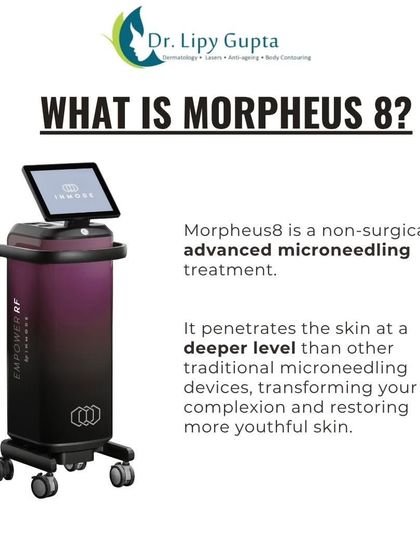 Morpheus8: Deep Skin Remodeling & Tightening photo 3