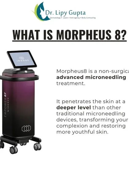 This explains what Morpheus8 technology is. The device penetrates the skin at a deeper level to transform your complexion and restore more youthful-looking skin by stimulating collagen production.