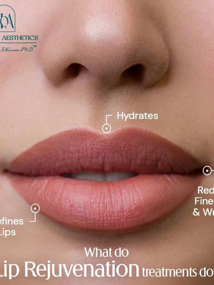 Lip rejuvenation treatments define, hydrate, and reduce fine lines for a naturally youthful look. It's the ultimate solution for giving your lips the care and attention they deserve.