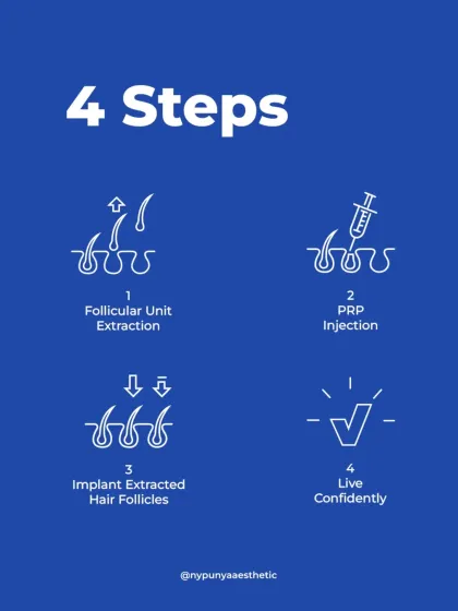Many people think a hair transplant is overwhelmingly complex, but the FUE method is a straightforward, four-step process. We extract individual follicles, prepare the scalp, implant them precisely for a natural look, and then you can get back to living confidently. It's a refined technique for permanent, scarless results.