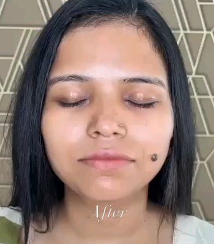 And here is the 'after'. The same client with glowing, hydrated skin, looking refreshed and revitalized immediately after her HydraFacial.