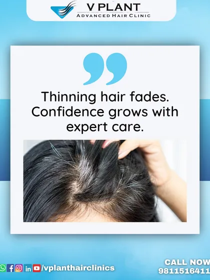 As thinning hair fades, confidence grows with our expert care. We combine scientifically backed solutions with customized plans to bring your confidence back, one strand at a time.