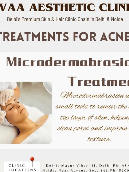 An introduction to Microdermabrasion, a treatment that exfoliates the top layer of dead skin to clean pores and refine skin texture, making it an effective option for managing acne.