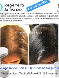 Hair Loss & Restoration