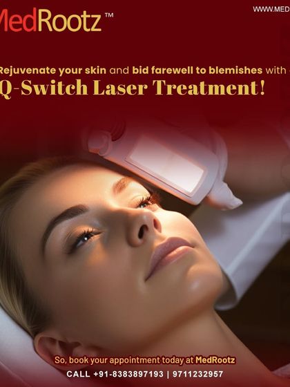 My Q-Switch laser treatment uses precise, rapid pulses of light to break down excess melanin in the skin. This is a highly effective method for reducing pigmentation and other blemishes with precision.