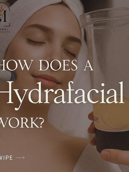 A glimpse into how a HydraFacial works, promising an instant glow with zero downtime. Swipe to see the process.