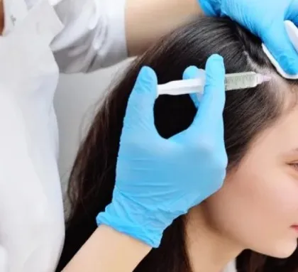 This is another view of the PRP treatment being administered. It is a safe and widely used procedure for stimulating hair growth in both men and women.