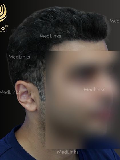 A different angle of the final result, highlighting the excellent density.