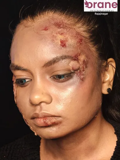 This close-up shows the incredible texture and detail of the SFX makeup, designed to look like a severe skin injury.
