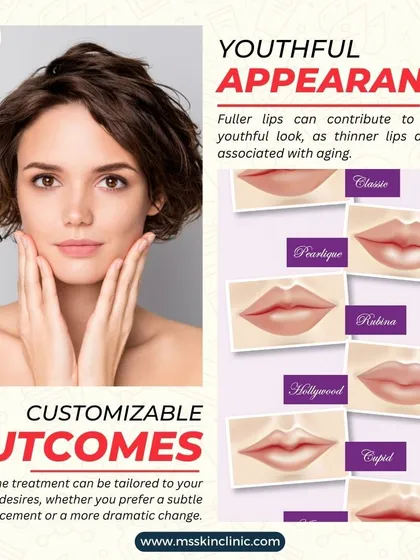 Lip augmentation is highly customizable. Whether you prefer a classic, subtle enhancement or a more defined "Hollywood" pout, I tailor the treatment to your specific desires and facial anatomy.
