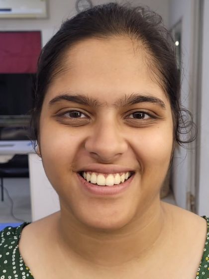 The Transformation: Before & After photo 18