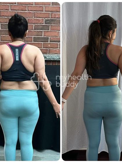 Another back view of Ruchika's 10kg weight loss, showing consistent progress.