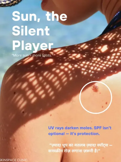 Sun exposure is a silent player in the development and darkening of moles. This is another critical reason why daily use of a high SPF sunscreen is not optional; it is essential protection.