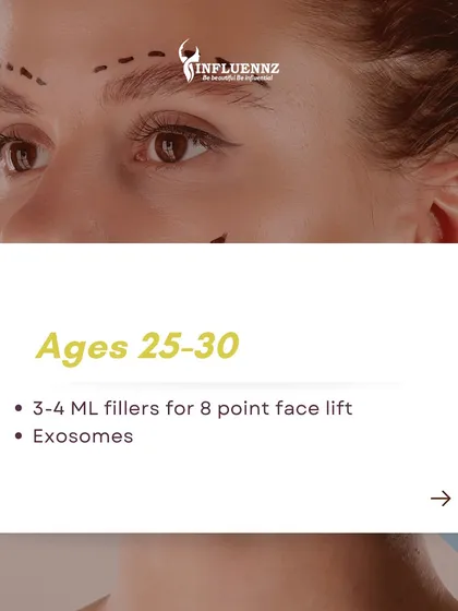 For preventative anti-aging in the 25-30 age group, an 8 point face lift using 3-4 ml of fillers can help maintain facial structure and youthfulness.