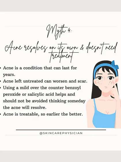 Myth 4: Acne resolves on its own. While some mild cases might, untreated acne can worsen and lead to permanent scarring. It is a treatable condition, and the earlier we start, the better the outcome.
