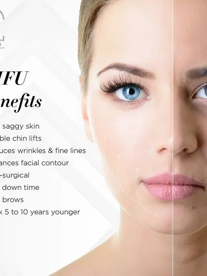 HIFU is my go-to for a non-surgical facelift. As you can see from the comparison, it effectively lifts sagging skin, smooths out wrinkles, and redefines facial contours for a naturally younger look.