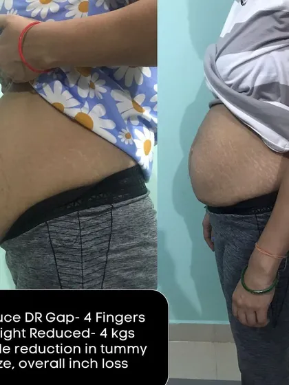 A duplicate of image 215, showing the 4-finger DR gap reduction and 4 kg weight loss. The visual proof is undeniable.