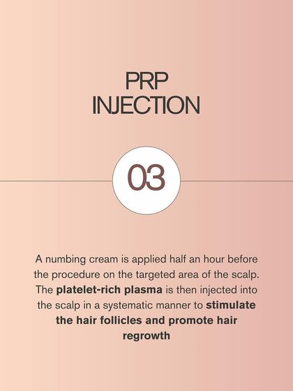 The final step is the PRP injection. After applying a topical numbing cream to ensure your comfort, I carefully inject the concentrated platelet-rich plasma into the areas of the scalp requiring treatment, stimulating the hair follicles directly.