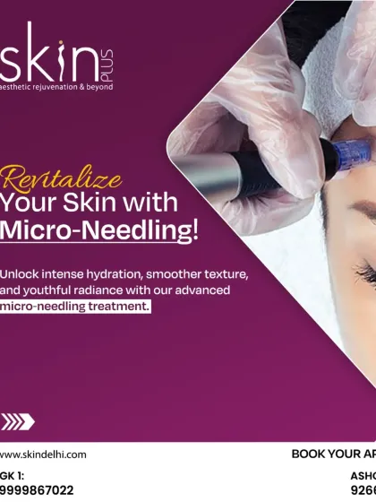 Collagen Boosting: Microneedling & PRP photo 7
