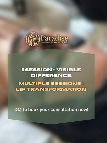 One session of my Carbon Lip Peel makes a visible difference, and multiple sessions lead to a complete lip transformation. It's the perfect solution for restoring your natural, even lip tone.