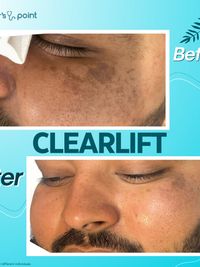 Skin Correction Treatments