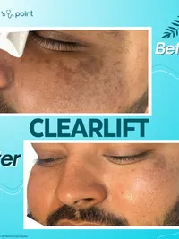 Skin Correction Treatments