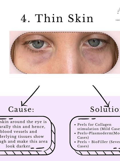 Clinic Next Face - Advanced Skin Treatments Targeted Solution: Under-Eye Care photo 6