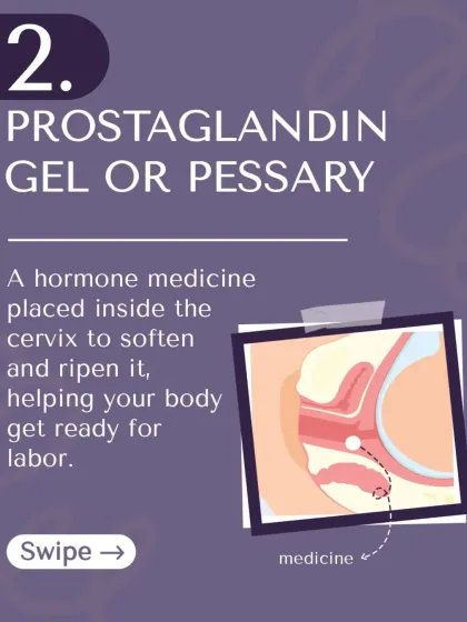 Method 2: Prostaglandin gel or pessary. This is a hormone medicine placed near the cervix to help it soften and ripen.