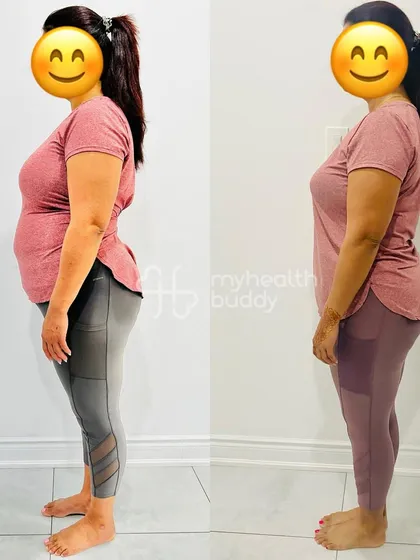 A working mom of two who lost 8 kgs in 6 months. Even with a busy routine and festivals, she stayed consistent, proving that you can balance life and still achieve your fitness goals.