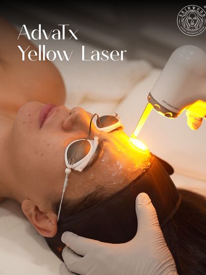 The ADVATx Yellow Laser in action. This US FDA-approved technology is my go-to for tackling redness, pigmentation, and providing an overall collagen boost with no downtime.