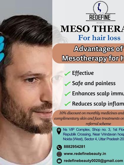 This graphic explains the advantages of Mesotherapy for hair loss. It is an effective and safe procedure that enhances scalp immunity and reduces inflammation to promote a healthier environment for hair growth.