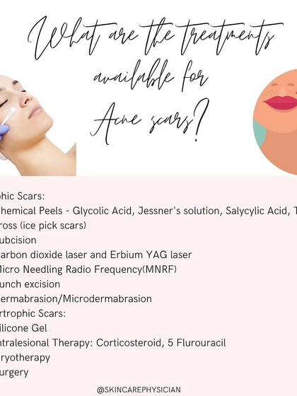 A wide range of treatments is available for acne scars. This includes chemical peels and subcision for atrophic scars, and intralesional therapy for hypertrophic scars.