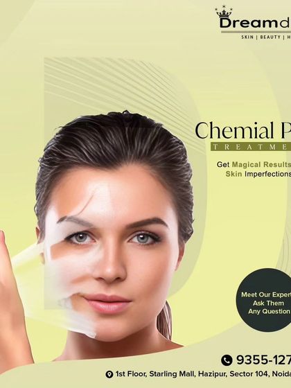 A visual representation of a Chemical Peel treatment, which gives magical results for skin imperfections by shedding dull skin to reveal a fresh, luminous complexion.