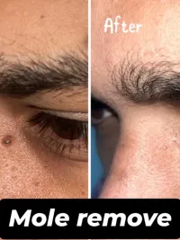 Medical Dermatology