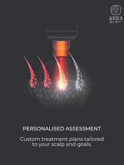 Every treatment plan starts with a personalized assessment. We analyze your specific pattern of hair loss, scalp condition, and goals to design a custom FUE transplant strategy that is tailored just for you.