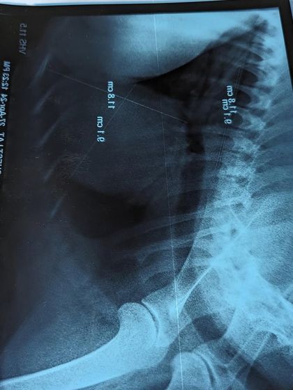 PL Paws - Animal Rescue & Rehabilitation How Your Donations Help: Our Medical Cases photo 17